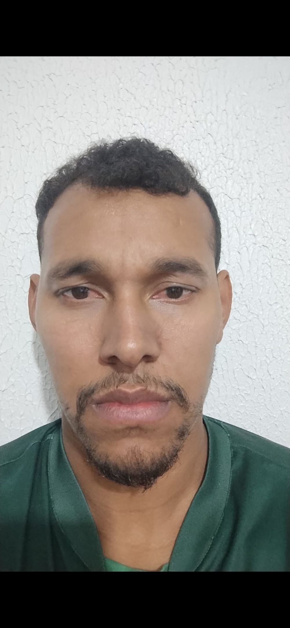 ANDELSON ALVES DOS SANTOS